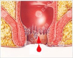 福州肛肠医院